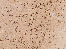 FAM181B Antibody - Immunochemical staining of human FAM181B in human brain with rabbit polyclonal antibody at 1:500 dilution, formalin-fixed paraffin embedded sections.