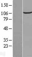 FAM186B Protein - Western validation with an anti-DDK antibody * L: Control HEK293 lysate R: Over-expression lysate
