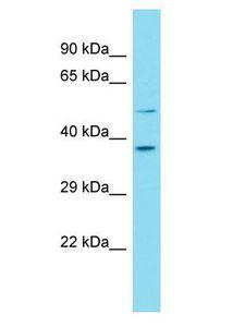 FAM187B Antibody - FAM187B antibody Western Blot of 721_B. Antibody dilution: 1 ug/ml.  This image was taken for the unconjugated form of this product. Other forms have not been tested.
