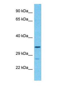 FAM189A1 Antibody - Western blot of FAM189A1 Antibody with human 293T Whole Cell lysate.  This image was taken for the unconjugated form of this product. Other forms have not been tested.
