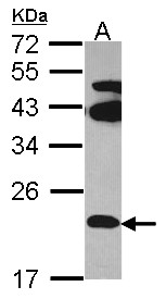 FAM18B Antibody - Sample (30 ug of whole cell lysate). A: Hela. 12% SDS PAGE. FAM18B antibody. FAM18B antibody diluted at 1:1000.