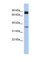 FAM190A Antibody - FAM190A antibody Western blot of Fetal Heart lysate. This image was taken for the unconjugated form of this product. Other forms have not been tested.