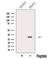 FAM192A / Nip30 Antibody - Western blot analysis of extracts of HeLa cells using NIP30 antibody. The lane on the left was treated with blocking peptide.