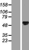 FAM196A Protein - Western validation with an anti-DDK antibody * L: Control HEK293 lysate R: Over-expression lysate