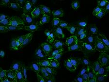 FAM198A Antibody - Immunofluorescence staining of FAM198A in U2OS cells. Cells were fixed with 4% PFA, permeabilzed with 0.3% Triton X-100 in PBS, blocked with 10% serum, and incubated with rabbit anti-Human FAM198A polyclonal antibody (dilution ratio 1:200) at 4°C overnight. Then cells were stained with the Alexa Fluor 488-conjugated Goat Anti-rabbit IgG secondary antibody (green) and counterstained with DAPI (blue). Positive staining was localized to Cytoplasm.