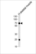 FAM198B / C4orf18 Antibody - Western blot of lysate from human skeletal muscle tissue lysate, using C4orf18 Antibody. Antibody was diluted at 1:1000 at each lane. A goat anti-rabbit IgG H&L (HRP) at 1:5000 dilution was used as the secondary antibody. Lysate at 35ug per lane.