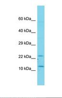 FAM19A1 Antibody - Western blot of Human Fetal Kidney. FAM19A1 antibody dilution 1.0 ug/ml.  This image was taken for the unconjugated form of this product. Other forms have not been tested.