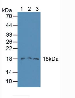 FAM19A2 / TAFA2 Antibody - Western Blot; Sample: Lane1: Mouse Liver Tissue; Lane2: Mouse Lung Tissue; Lane3: Mouse Pancreas Tissue.