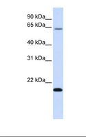 FAM19A3 Antibody - Fetal liver lysate. Antibody concentration: 1.0 ug/ml. Gel concentration: 12%.  This image was taken for the unconjugated form of this product. Other forms have not been tested.