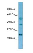 FAM19A4 Antibody - FAM19A4 antibody Western Blot of Rat Kidney.  This image was taken for the unconjugated form of this product. Other forms have not been tested.