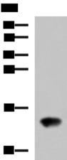 FAM19A4 Antibody - Western blot analysis of Rat kidney tissue lysate  using FAM19A4 Polyclonal Antibody at dilution of 1:650