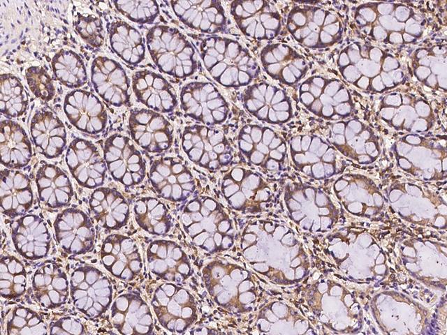 FAM200A Antibody - Immunochemical staining of human FAM200A in human rectum with rabbit polyclonal antibody at 1:500 dilution, formalin-fixed paraffin embedded sections.