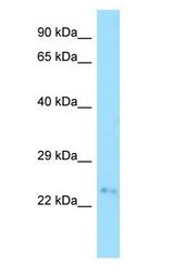 FAM207A Antibody - FAM207A antibody Western Blot of Fetal Small Intestine.  This image was taken for the unconjugated form of this product. Other forms have not been tested.