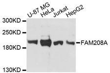 FAM208A Antibody - Western blot analysis of extracts of various cell lines, using FAM208A antibody at 1:3000 dilution. The secondary antibody used was an HRP Goat Anti-Rabbit IgG (H+L) at 1:10000 dilution. Lysates were loaded 25ug per lane and 3% nonfat dry milk in TBST was used for blocking. An ECL Kit was used for detection and the exposure time was 30s.