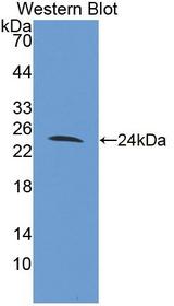 FAM20A Antibody - Western blot of FAM20A antibody.