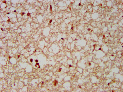 FAM20C Antibody - Immunohistochemistry image at a dilution of 1:500 and staining in paraffin-embedded human brain tissue performed on a Leica BondTM system. After dewaxing and hydration, antigen retrieval was mediated by high pressure in a citrate buffer (pH 6.0) . Section was blocked with 10% normal goat serum 30min at RT. Then primary antibody (1% BSA) was incubated at 4 °C overnight. The primary is detected by a biotinylated secondary antibody and visualized using an HRP conjugated SP system.