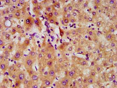 FAM20C Antibody - Immunohistochemistry image at a dilution of 1:500 and staining in paraffin-embedded human liver tissue performed on a Leica BondTM system. After dewaxing and hydration, antigen retrieval was mediated by high pressure in a citrate buffer (pH 6.0) . Section was blocked with 10% normal goat serum 30min at RT. Then primary antibody (1% BSA) was incubated at 4 °C overnight. The primary is detected by a biotinylated secondary antibody and visualized using an HRP conjugated SP system.