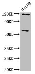 FAM20C Antibody - Positive Western Blot detected in HepG2 whole cell lysate. All lanes: FAM20C antibody at 4.1 µg/ml Secondary Goat polyclonal to rabbit IgG at 1/50000 dilution. Predicted band size: 67, 30 KDa. Observed band size: 67 KDa
