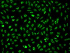 FAM212A Antibody - Immunofluorescence staining of C3orf54 in U2OS cells. Cells were fixed with 4% PFA, permeabilzed with 0.3% Triton X-100 in PBS, blocked with 10% serum, and incubated with rabbit anti-Human C3orf54 polyclonal antibody (dilution ratio 1:200) at 4°C overnight. Then cells were stained with the Alexa Fluor 488-conjugated Goat Anti-rabbit IgG secondary antibody (green). Positive staining was localized to Nucleus.