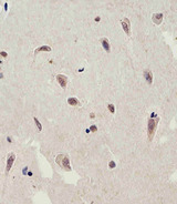 FAM216B Antibody - Immunohistochemical of paraffin-embedded H.brain section using C13orf30 Antibody. Antibody was diluted at 1:25 dilution. A peroxidase-conjugated goat anti-rabbit IgG at 1:400 dilution was used as the secondary antibody, followed by DAB staining.