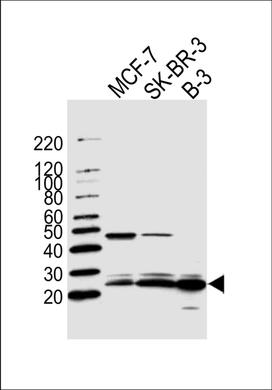 FAM216B Antibody - Western blot of lysates from MCF-7, SK-BR-3, B-3 cell line (from left to right) with C13orf30 Antibody. Antibody was diluted at 1:1000 at each lane. A goat anti-rabbit IgG H&L (HRP) at 1:5000 dilution was used as the secondary antibody. Lysates at 35 ug per lane.