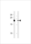 FAM216B Antibody - C13orf30 Antibody western blot of B-3,MCF-7 cell line lysates (35 ug/lane). The C13orf30 antibody detected the C13orf30 protein (arrow).