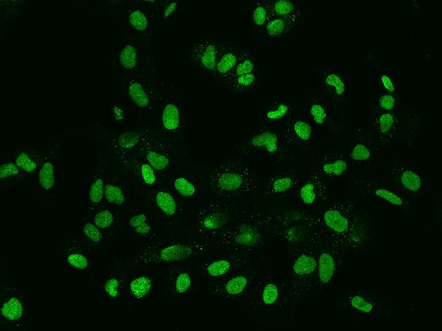 FAM217B / C20orf177 Antibody - Immunofluorescence staining of C20orf177 in U2OS cells. Cells were fixed with 4% PFA, permeabilzed with 0.1% Triton X-100 in PBS, blocked with 10% serum, and incubated with rabbit anti-Human C20orf177 polyclonal antibody (dilution ratio 1:200) at 4°C overnight. Then cells were stained with the Alexa Fluor 488-conjugated Goat Anti-rabbit IgG secondary antibody (green). Positive staining was localized to Nucleus.
