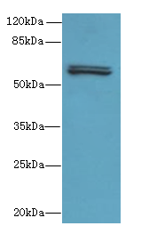 FAM222B Antibody - Western blot. All lanes: FAM222B antibody at 2 ug/ml+Mos- liver tissue Goat polyclonal to rabbit at 1:10000 dilution. Predicted band size: 60 kDa. Observed band size: 60 kDa.