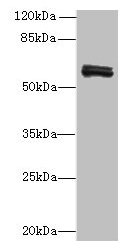 FAM222B Antibody - Western blot All lanes: FAM222B antibody at 2µg/ml + Mouse liver tissue Secondary Goat polyclonal to rabbit IgG at 1/10000 dilution Predicted band size: 60 kDa Observed band size: 60 kDa