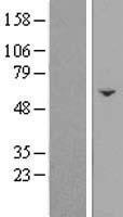 FAM222B Protein - Western validation with an anti-DDK antibody * L: Control HEK293 lysate R: Over-expression lysate