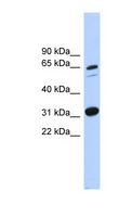 FAM234A Antibody - ITFG3 antibody Western blot of MCF7 cell lysate. This image was taken for the unconjugated form of this product. Other forms have not been tested.