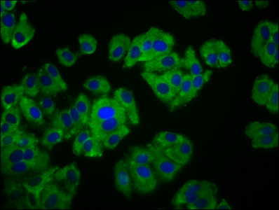 FAM234A Antibody - Immunofluorescence staining of HepG2 cells diluted at 1:133, counter-stained with DAPI. The cells were fixed in 4% formaldehyde, permeabilized using 0.2% Triton X-100 and blocked in 10% normal Goat Serum. The cells were then incubated with the antibody overnight at 4°C.The Secondary antibody was Alexa Fluor 488-congugated AffiniPure Goat Anti-Rabbit IgG (H+L).