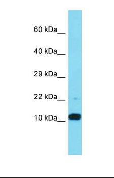 FAM25A Antibody - Western blot of Jurkat. FAM25A antibody dilution 1.0 ug/ml.  This image was taken for the unconjugated form of this product. Other forms have not been tested.