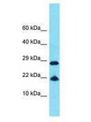 FAM25E Antibody - FAM25E antibody Western Blot of COLO205. Antibody dilution: 1 ug/ml.  This image was taken for the unconjugated form of this product. Other forms have not been tested.