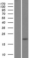 FAM26D Protein - Western validation with an anti-DDK antibody * L: Control HEK293 lysate R: Over-expression lysate