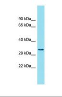 FAM26E Antibody - Western blot of Fetal Lung. FAM26E antibody dilution 1.0 ug/ml.  This image was taken for the unconjugated form of this product. Other forms have not been tested.