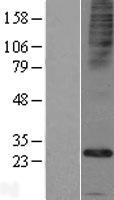 FAM26E Protein - Western validation with an anti-DDK antibody * L: Control HEK293 lysate R: Over-expression lysate