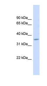 FAM26F Antibody - FAM26F antibody Western blot of Fetal Muscle lysate. This image was taken for the unconjugated form of this product. Other forms have not been tested.