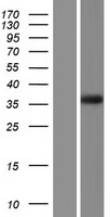 FAM26F Protein - Western validation with an anti-DDK antibody * L: Control HEK293 lysate R: Over-expression lysate
