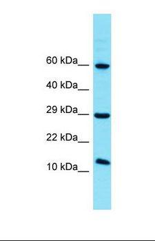 FAM32A Antibody - Western blot of Human HCT15. FAM32A antibody dilution 1.0 ug/ml.  This image was taken for the unconjugated form of this product. Other forms have not been tested.