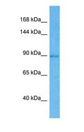 FAM35A Antibody - Western blot of FAM35A Antibody with human Lung Tumor lysate.  This image was taken for the unconjugated form of this product. Other forms have not been tested.
