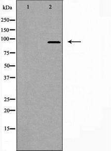 FAM35A Antibody - Western blot analysis of extracts of Jurkat cells using FAM35A/B antibody. The lane on the left is treated with the antigen-specific peptide.