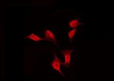 FAM35A Antibody - Staining HeLa cells by IF/ICC. The samples were fixed with PFA and permeabilized in 0.1% Triton X-100, then blocked in 10% serum for 45 min at 25°C. The primary antibody was diluted at 1:200 and incubated with the sample for 1 hour at 37°C. An Alexa Fluor 594 conjugated goat anti-rabbit IgG (H+L) Ab, diluted at 1/600, was used as the secondary antibody.