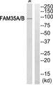 FAM35A + FAM35B Antibody - Western blot analysis of extracts from Jurkat cells, using FAM35A/B antibody.