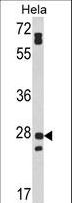 FAM3B Antibody - Western blot of FAM3B Antibody in HeLa cell line lysates (35 ug/lane). FAM3B (arrow) was detected using the purified antibody.