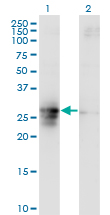 FAM3B Antibody - Western blot of FAM3B expression in transfected 293T cell line by FAM3B monoclonal antibody (M07), clone 1E7.
