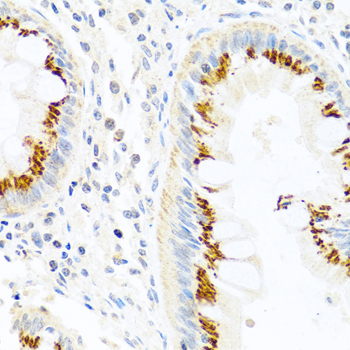 FAM3B Antibody - Immunohistochemistry of formalin-fixed paraffin-embedded (FFPE) human colon using FAM3B antibody at dilution of 1:100 (40x magnification).