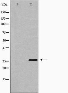 FAM3B Antibody - Western blot analysis of PC-3 lysate using FAM3B antibody. The lane on the left is treated with the antigen-specific peptide.
