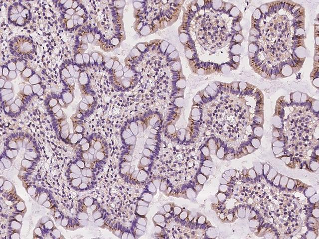 FAM3B Antibody - Immunochemical staining of human FAM3B in human small intestine with rabbit polyclonal antibody at 1:100 dilution, formalin-fixed paraffin embedded sections.