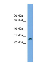 FAM3D Antibody - FAM3D antibody Western blot of Jurkat lysate. This image was taken for the unconjugated form of this product. Other forms have not been tested.
